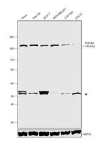 ROCK2 Antibody in Western Blot (WB)