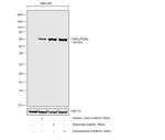 Phospho-CHK2 (Thr68) Antibody in Western Blot (WB)