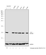 DJ-1 Antibody