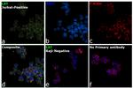 LAT Antibody in Immunocytochemistry (ICC/IF)