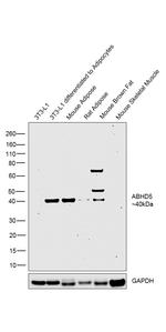 ABHD5 Antibody in Western Blot (WB)