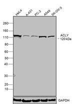 ATP Citrate Lyase Antibody in Western Blot (WB)