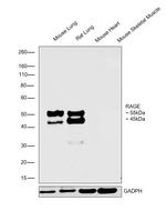 RAGE Antibody in Western Blot (WB)