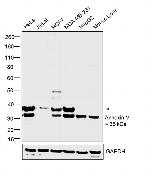 Annexin V Antibody in Western Blot (WB)