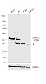 CYP11A1 Antibody in Western Blot (WB)