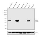 CYP2E1 Antibody in Western Blot (WB)