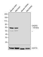 GAD65 Antibody in Western Blot (WB)