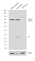 GRK2 Antibody in Western Blot (WB)