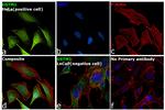 GSTM1 Antibody