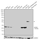 GSTM1 Antibody in Western Blot (WB)