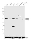 hnRNP L Antibody in Western Blot (WB)