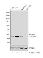 IGFBP2 Antibody in Western Blot (WB)