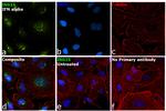 ISG15 Antibody in Immunocytochemistry (ICC/IF)