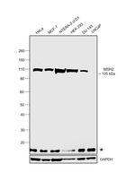 MSH2 Antibody in Western Blot (WB)