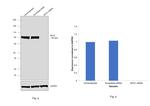 MTA1 Antibody in Western Blot (WB)