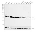 NME1 Antibody in Western Blot (WB)