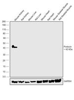 Podocin Antibody in Western Blot (WB)