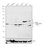 PTPN2 Antibody in Western Blot (WB)