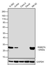 RAB27A Antibody in Western Blot (WB)