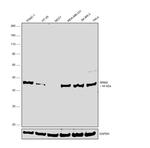 RRM2 Antibody in Western Blot (WB)