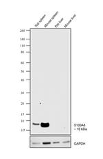 S100A8 Antibody in Western Blot (WB)