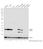 S100A9 Antibody in Western Blot (WB)