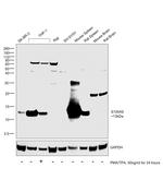 S100A9 Antibody in Western Blot (WB)