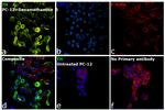 Tyrosine Hydroxylase Antibody