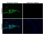 E-cadherin Antibody in Immunohistochemistry (Paraffin) (IHC (P))