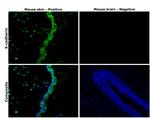 E-cadherin Antibody in Immunohistochemistry (Paraffin) (IHC (P))