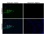 E-cadherin Antibody