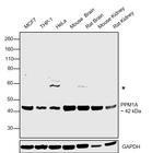 PPM1A Antibody in Western Blot (WB)