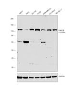 PIK3CB Antibody in Western Blot (WB)