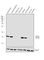 PGP9.5 Antibody