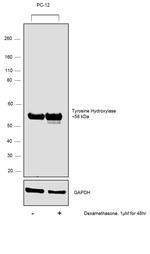 Tyrosine Hydroxylase Antibody in Western Blot (WB)