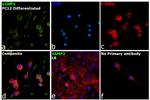 VAMP2 Antibody in Immunocytochemistry (ICC/IF)