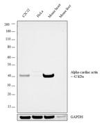 alpha-Cardiac Actin Antibody in Western Blot (WB)