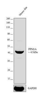 PPM1A Antibody in Western Blot (WB)