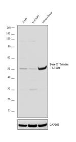 Beta III Tubulin Antibody in Western Blot (WB)