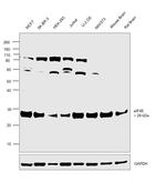 eIF4E Antibody in Western Blot (WB)