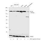 PLCG2 Antibody in Western Blot (WB)