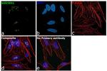 SUV39H1 Antibody in Immunocytochemistry (ICC/IF)