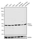 PPM1A Antibody in Western Blot (WB)