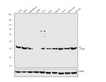 ILK Antibody in Western Blot (WB)