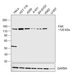 FAK Antibody in Western Blot (WB)