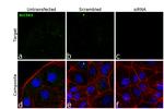 SGLT1 Antibody in Immunocytochemistry (ICC/IF)