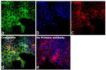 NME1/NME2 Antibody in Immunocytochemistry (ICC/IF)