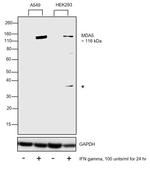 MDA5 Antibody