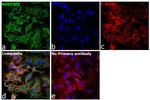 NDUFAF2 Antibody in Immunocytochemistry (ICC/IF)