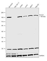 PLCG1 Antibody in Western Blot (WB)